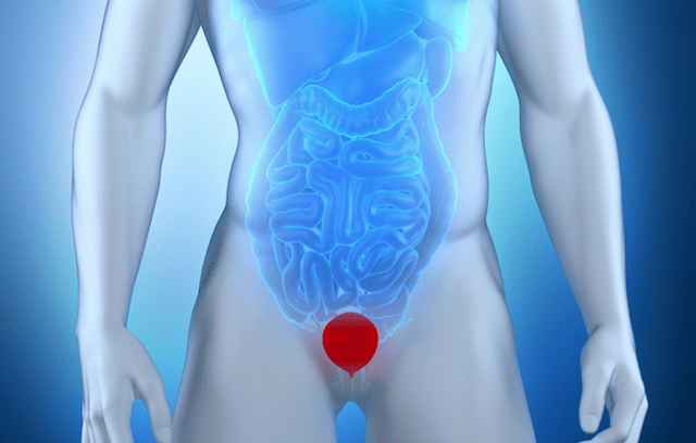 Low Pressure Fitness para incontinência urinária após cirurgia de próstata